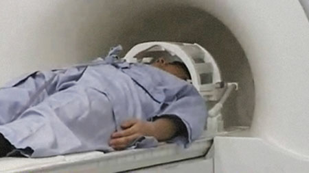 뇌건강과 영상의학