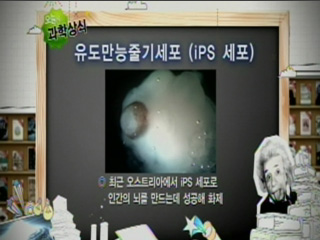 유도만능줄기세포 (IPS 세포)