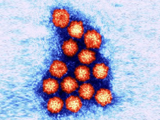 노로바이러스 (Norovirus)