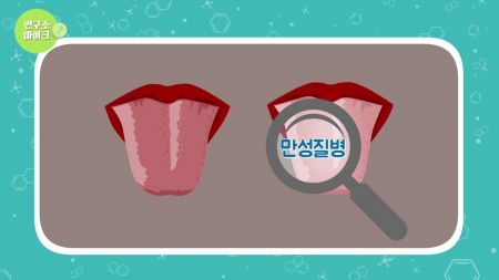 [연구소마이크] 혀만 보면 안다! '설진' 만성질병 진단기술…한의학연구원
