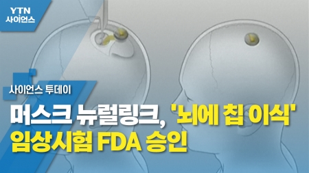 머스크 뉴럴링크, '뇌에 칩 이식' 임상시험 FDA 승인