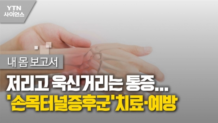 [내 몸 보고서] 저리고 욱신거리는 통증…'손목터널증후군'치료·예방