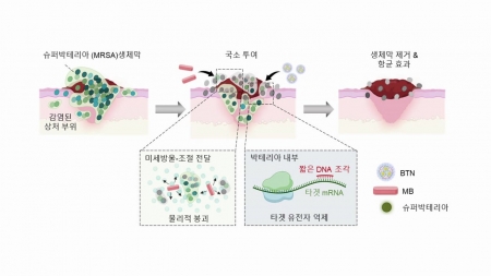 나노입자로 슈퍼박테리아 제거하는 치료법 개발