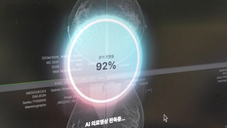 MRI·CT 등 의료장비 품질검사, 인공지능으로 빠르고 정확하게!