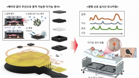 욕창 조기 진단하는 나노소재 기반 무선 센서 개발