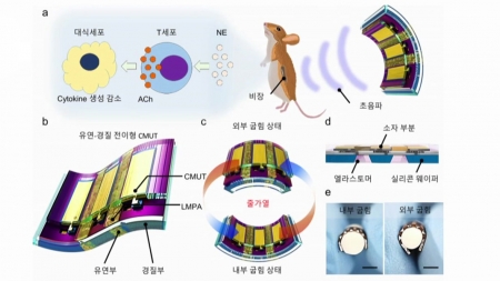 [사이다] ② 유연한 초음파 센서
