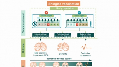 "대상포진 백신, 치매 위험 낮추고 진행도 늦춘다"