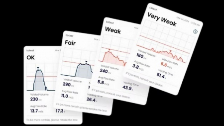 스마트폰으로 배뇨 상태 측정…음향 배뇨 측정 기술 개발