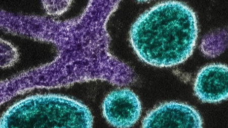 질병청, ’니파바이러스’ 인도·방글라 중점검역지역 지정