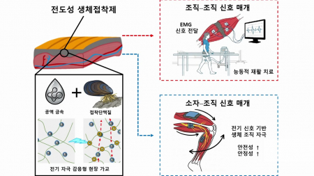 장기에 붙일 수 있는 '전도성 생체 접착제' 개발 