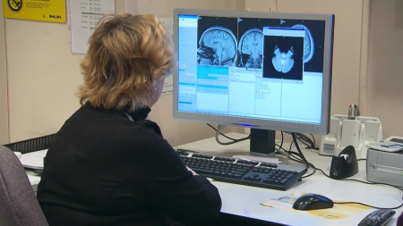 폐경이 뇌 회백질 감소 유발...여성이 치매 많은 이유?