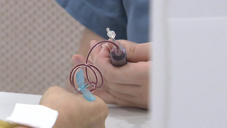 [사이다] ② "비만대사수술 효과, 약물로 재현"