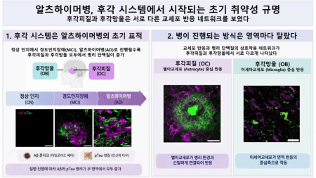 치매 초기 뇌 후각 시스템 면역세포 메커니즘 규명