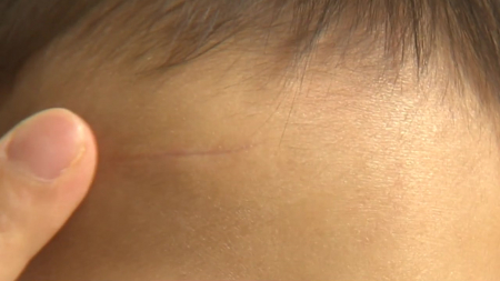 병원 안 가본 6세 이하 5.8만 명 조사...아동학대 법정형 강화 검토