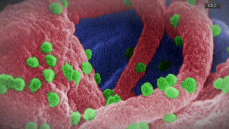 "한 번 주사로 2년간 HIV 억제"…반영구 치료 기대감