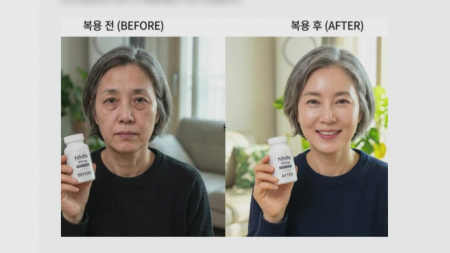 역노화 제품이라더니...알고 보니 AI 가짜 의사