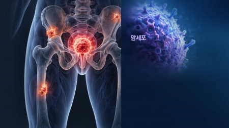 수입만 하던 '암 추적 미사일'...한국서도 만드나?