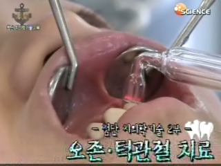첨단 치의학 기술 2부 - 오존, 턱관절 치료