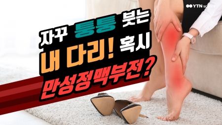 자꾸 퉁퉁 붓는 내 다리! 혹시 만성정맥부전?