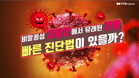 비알콜성 지방간에서 유래된 간암, 빠른 진단법이 있을까?