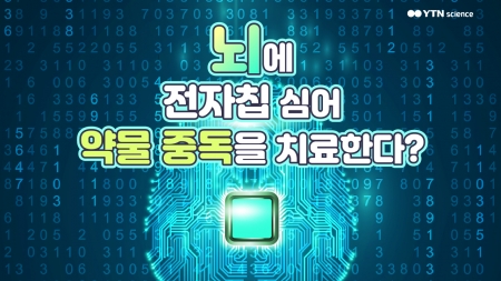뇌에 전자칩 심어 약물 중독을 치료한다?