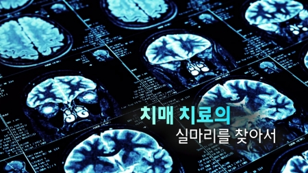 치매 치료의 실마리를 찾아서