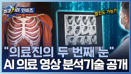 AI로 의료의 혁신을 열다! AI 의료장비 영상 분석기술